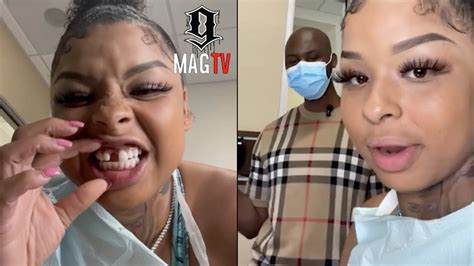 chrisean rock missing teeth|Chrisean Rock Finally Visits Dentist To Fix Her Missing Tooth!